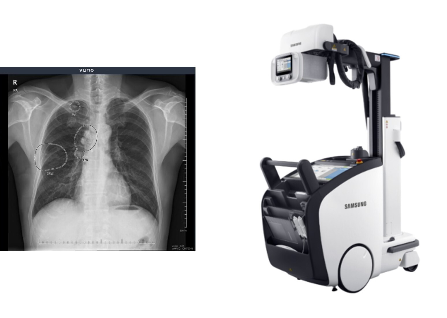 Система xray. Siger Digital x-ray Imaging System. Мобильный рентгенографический аппарат Samsung gm85. Цифровой рентген. Передвижной рентген.